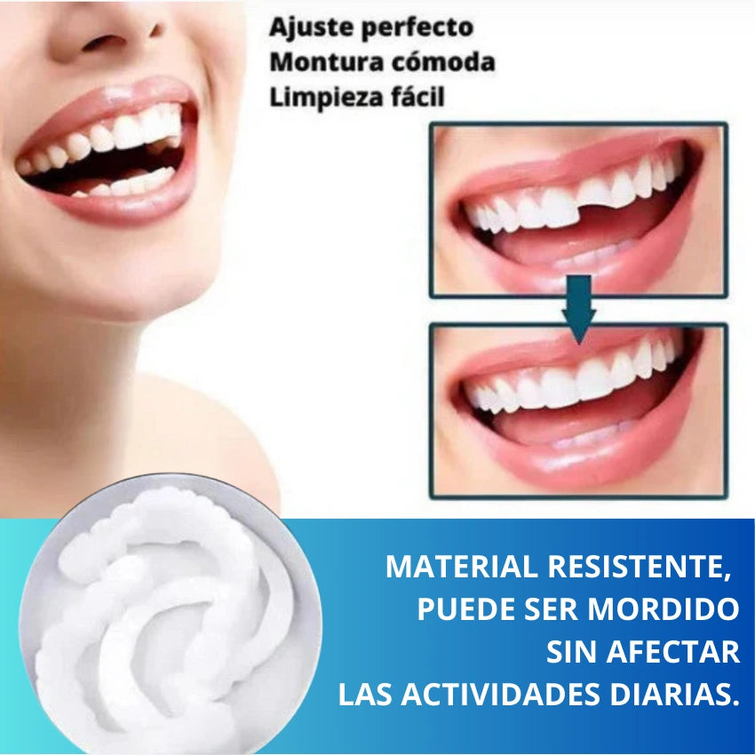 ✨ Carillas Dentales SnapOn Smile™: belleza instantánea para tu Sonrisa✨